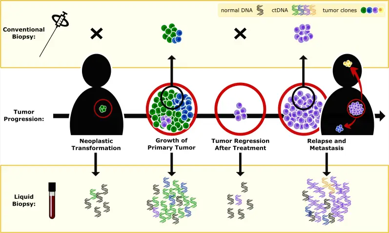 Flüssigbiopsie Methode im Vergleich zu konventioneller Biopsie | Grafik: Anmery, Eigenes Werk, CC BY-SA 4.0, https://commons.wikimedia.org/w/index.php?curid=56707263