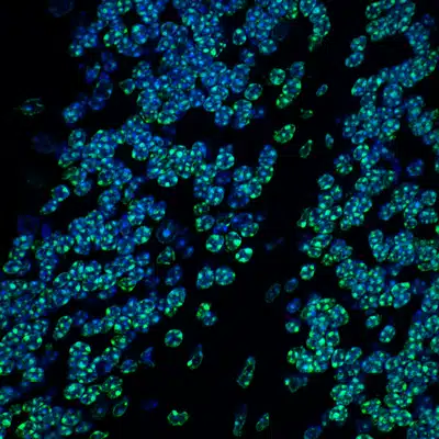Immunfluoreszenzfärbung des Mäusegehirns. Die DNA in den Zellkernen ist in blau dargestellt. In Grün ist die Trimethylierung von Lysin 9 auf Histon H3 (H3K9me3) dargestellt, ein Indikator für stillgelegtes Heterochromatin. | Foto: Hagelkruys/IMBA