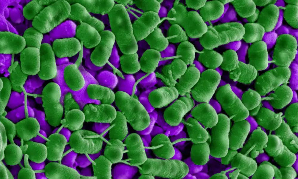 Bakteriocine perforieren rivalisierende Bakterien: Listerien (grün) sterben nach Exposition gegenüber Plantacyclin B21AG. Die sichtbaren Unebenheiten auf vielen der Zellen sind die bereits auslaufenden Zellinhalte. | Foto: Dr Elvina Parlindungan, RMIT