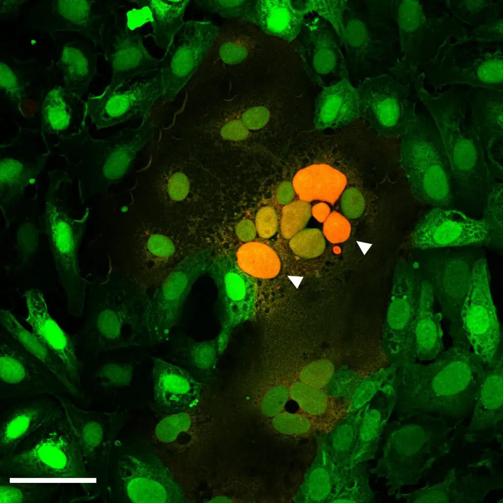 Mikroskopische Aufnahme durch Spikeprotein verschmolzene Zellen. Pfeile zeigen auf eine Zusammenlagerung von Zellkernen (orange) mehrerer verschmolzener Zellen. | Bild: Samuel A. Theuerkauf, PEI