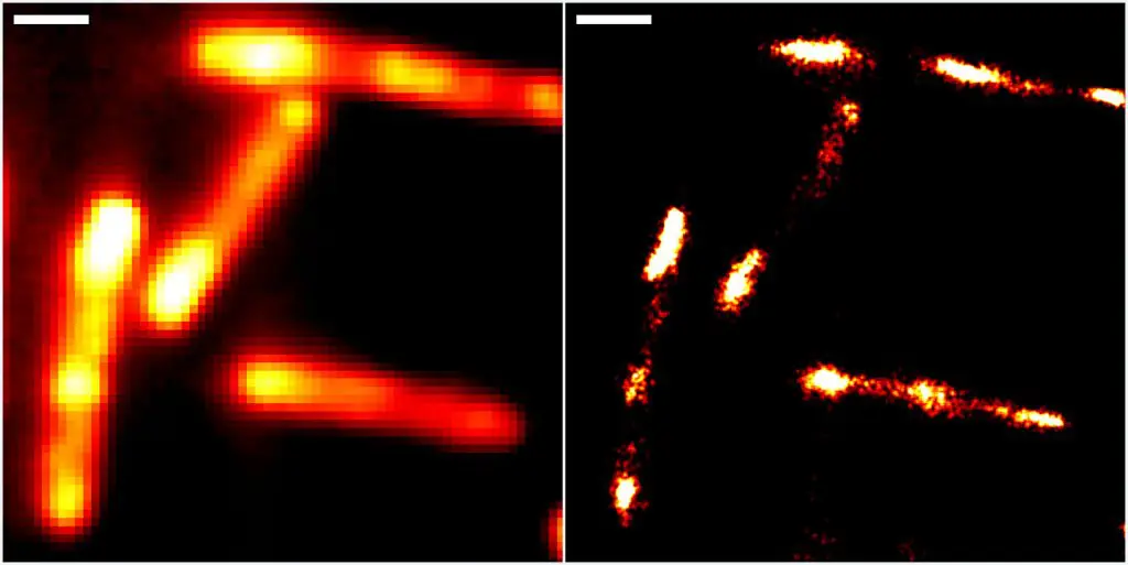 Abbildungen von Darmbakterien mit konventioneller Epifluoreszenzmikroskopie (links) und höchstauflösender Einzelmolekül-Lokalisationsmikroskopie unter Einsatz des neuen RhoBAST-Farbstoff-Marker-Komplexes zur Fluoreszenzmarkierung. Skalenbalken: 1 µm. | Bild: IPMB, KIT